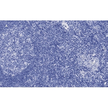 抗-CD8a抗体，克隆1B19，ZooMAb®兔单克隆抗体，25UL，ZRB1010-25UL，Sigma