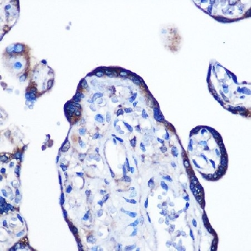 Anti-Alkaline Phosphatase (ALPL) antibody produced in rabbit，100UL，SAB5700875-100UL，Sigma