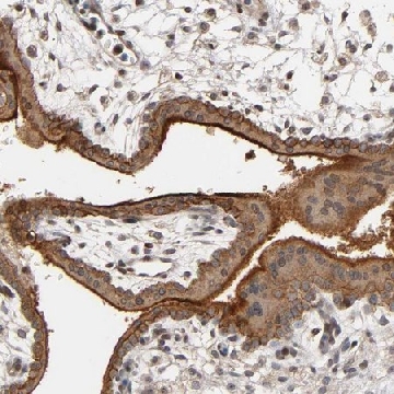 Anti-ITGAV antibody produced in rabbit，100UL，HPA004856-100UL，Sigma
