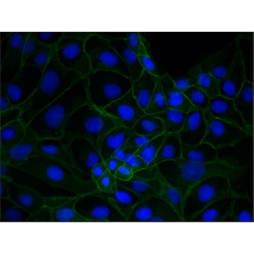 Monoclonal Anti-Plakoglobin (Catenin γ) antibody produced in mouse，0.2ML，P8087-.2ML，Sigma