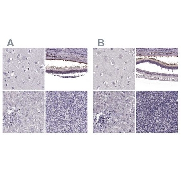 Anti-RP1L1 antibody produced in rabbit，100UL，HPA024686-100UL，Sigma