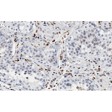 Anti-PRRX1 Antibody, clone 1L16 ZooMAb® Rabbit Monoclonal，25UL，ZRB2165-25UL，Sigma