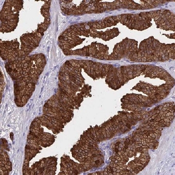Anti-DBI antibody produced in rabbit，100UL，HPA051428-100UL，Sigma
