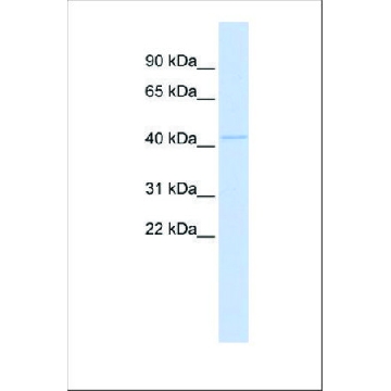 Anti-MITF antibody produced in rabbit，100UL，SAB2108175-100UL，Sigma
