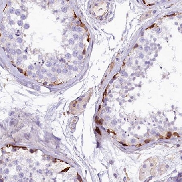 Anti-CMTR2 antibody produced in rabbit，100UL，HPA041700-100UL，Sigma