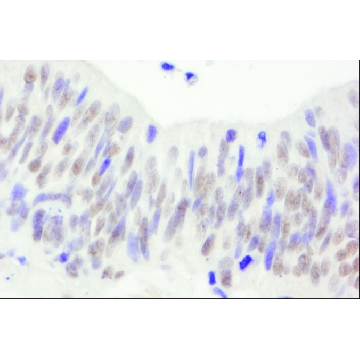 Rabbit anti-NBS1 Antibody, Affinity Purified，100UL，PLA0179-100UL，Sigma