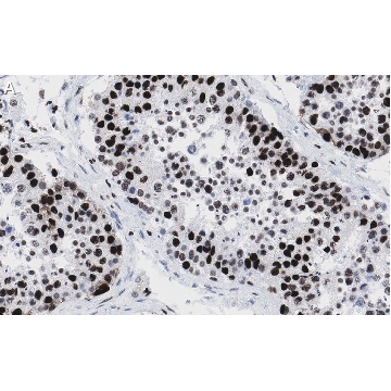 Anti-POLR2A Antibody, clone 3G21 ZooMAb® Rabbit Monoclonal，25UL，ZRB1409-25UL，Sigma