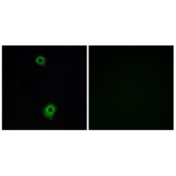 抗-HTR1B 兔抗，100UG，SAB4501471-100UG，Sigma