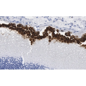 Anti-RPE65 Antibody, clone 2F8 ZooMAb® Rabbit Monoclonal，25UL，ZRB1640-25UL，Sigma