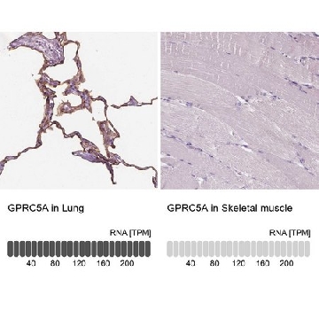 Anti-GPRC5A antibody produced in rabbit，100UL，HPA007928-100UL，Sigma