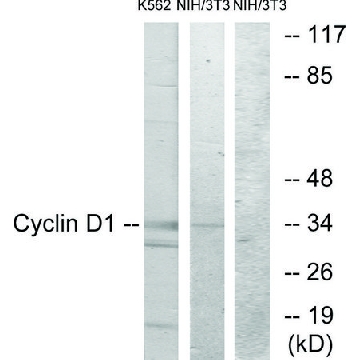 Anti-CYCLIN D1 antibody produced in rabbit，100UG，SAB4502603-100UG，Sigma