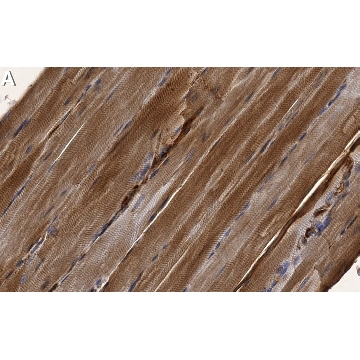 Anti-Axl Antibody, clone 3D13 ZooMAb® Rabbit Monoclonal，25UL，ZRB1956-25UL，Sigma