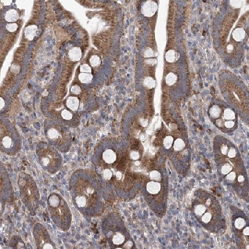 Anti-MTRF1L antibody produced in rabbit，100UL，HPA036367-100UL，Sigma