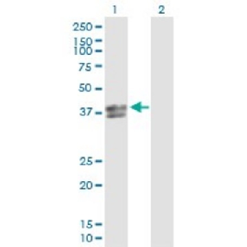 Anti-INHBE antibody produced in rabbit，100UG，SAB1401873-100UG，Sigma