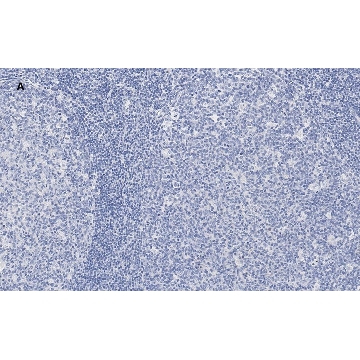 Anti-NF-kB p50/105 Antibody, clone 1N19, ZooMAb® Rabbit Monoclonal，25UL，ZRB2082-25UL，Sigma