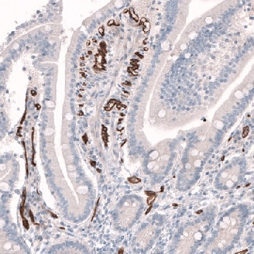Anti-PLVAP antibody produced in rabbit，100UL，HPA002279-100UL，Sigma