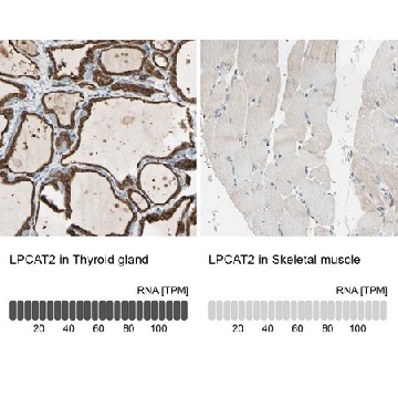 抗-LPCAT2 兔抗，100UL，HPA007891-100UL，Sigma