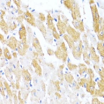 Anti-CTGF antibody produced in rabbit，100UL，SAB5700677-100UL，Sigma