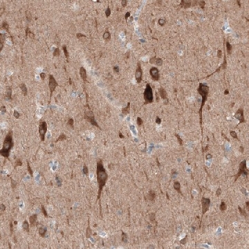 Anti-PTPRD antibody produced in rabbit，100UL，HPA054829-100UL，Sigma