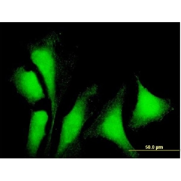 Anti-G3BP1 antibody produced in mouse，50UG，SAB1406936-50UG，Sigma