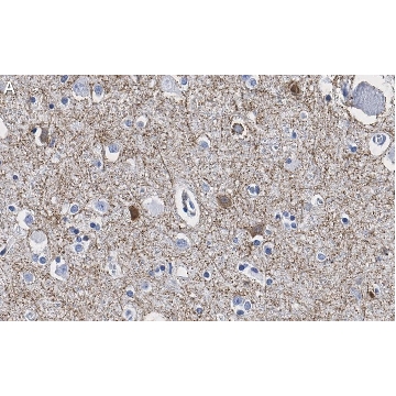 Anti-GAD65 Antibody, clone 3B23 ZooMAb® Rabbit Monoclonal，25UL，ZRB1091-25UL，Sigma