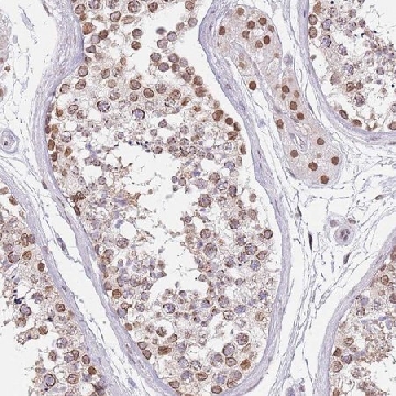 Anti-KLHDC2 antibody produced in rabbit，100UL，HPA000628-100UL，Sigma