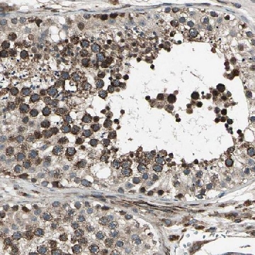 ANTI-EXD2 antibody produced in rabbit，100UL，HPA005848-100UL，Sigma