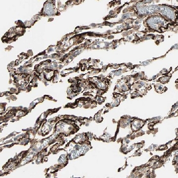 Anti-CALCRL antibody produced in rabbit，100UL，HPA008070-100UL，Sigma