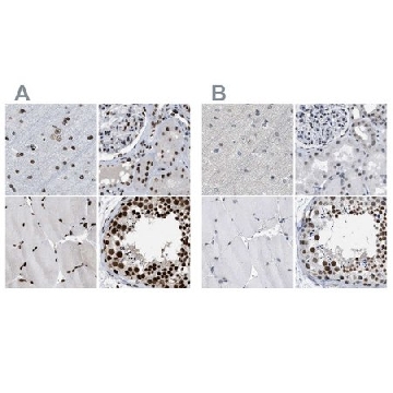 Anti-SCAF4 antibody produced in rabbit，100UL，HPA018319-100UL，Sigma