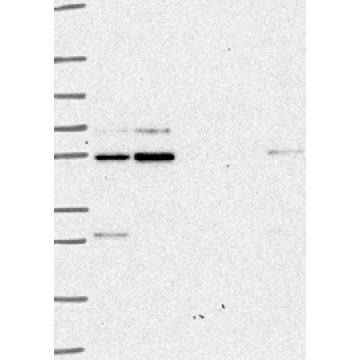 Anti-GLIS2 antibody produced in rabbit，100UL，HPA062755-100UL，Sigma