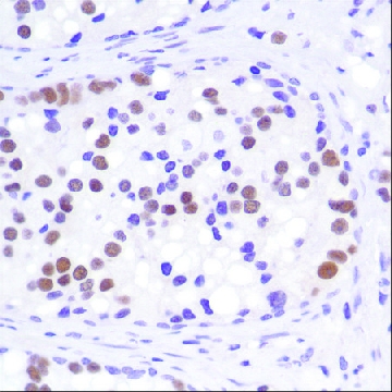 Anti-Androgen Receptor (C-term) antibody, Rabbit monoclonal，100UL，SAB5500007-100UL，Sigma