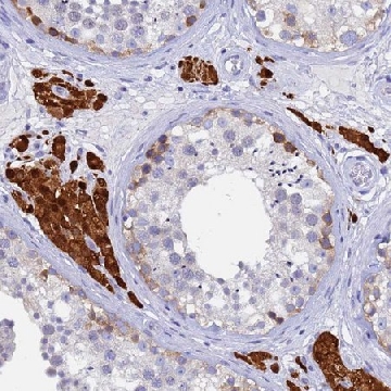 Anti-UBE2O antibody produced in rabbit，100UL，HPA023605-100UL，Sigma