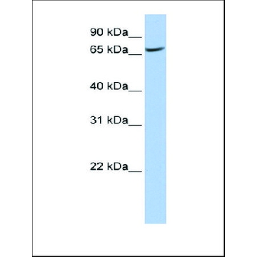 Anti-ATP6V0A1 antibody produced in rabbit，100UL，SAB2108042-100UL，Sigma