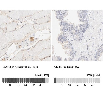 Anti-SPTB antibody produced in rabbit，100UL，HPA003394-100UL，Sigma