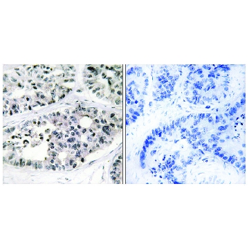 Anti-Collagen VII α1 antibody produced in rabbit，100UG，SAB4500390-100UG，Sigma