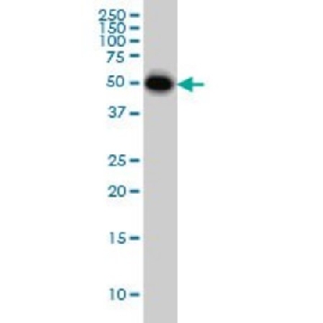 Monoclonal Anti-CRLF1 antibody produced in mouse，100UG，WH0009244M1-100UG，Sigma
