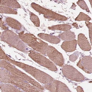 Anti-NMRK2 antibody produced in rabbit，100UL，HPA072450-100UL，Sigma