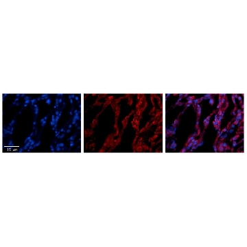 Anti-TAP1 antibody produced in rabbit，100UL，SAB2102370-100UL，Sigma