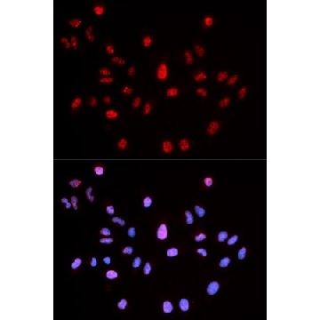 Anti-Phospho-ATM-S1981 antibody produced in rabbit，100UL，SAB5700279-100UL，Sigma