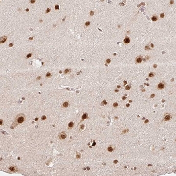 Anti-INTS8 antibody produced in rabbit，100UL，HPA057299-100UL，Sigma