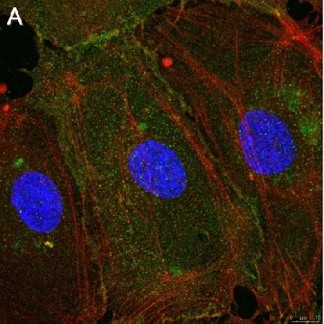 Anti-Integrin αVβ3 Antibody, clone LM609 ZooMAb® Mouse Monoclonal，25UL，ZMS1030-25UL，Sigma