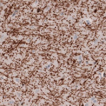 Monoclonal Anti-MBP antibody produced in mouse，100UL，AMAB91063-100UL，Sigma