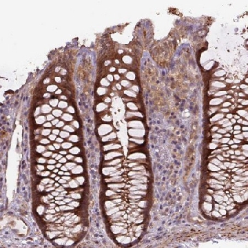 Anti-ZSWIM7 antibody produced in rabbit，100UL，HPA054681-100UL，Sigma