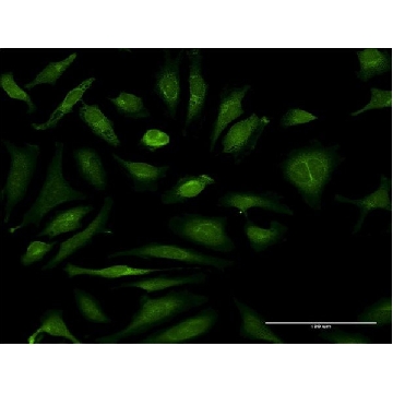 Monoclonal Anti-CSAD antibody produced in mouse，50UG，SAB1401692-50UG，Sigma