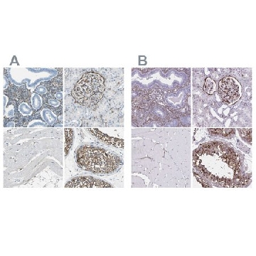 Anti-AKAP12 antibody produced in rabbit，100UL，HPA006344-100UL，Sigma