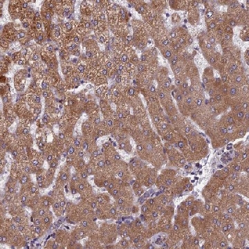 Anti-FADS1 antibody produced in rabbit，100UL，HPA042705-100UL，Sigma