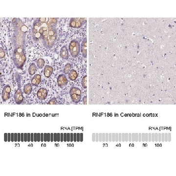 Anti-RNF186 antibody produced in rabbit，100UL，HPA034547-100UL，Sigma