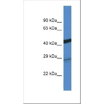 Anti-DGAT2 antibody produced in rabbit，100UL，SAB2106887-100UL，Sigma
