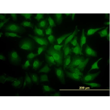 Monoclonal Anti-YBX1 antibody produced in mouse，100UG，WH0004904M1-100UG，Sigma