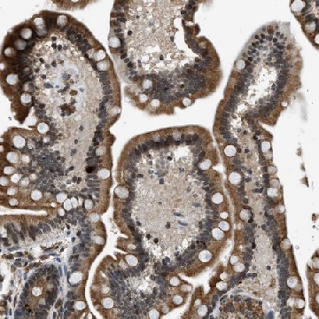 Anti-FAM134C antibody produced in rabbit，100UL，HPA016492-100UL，Sigma